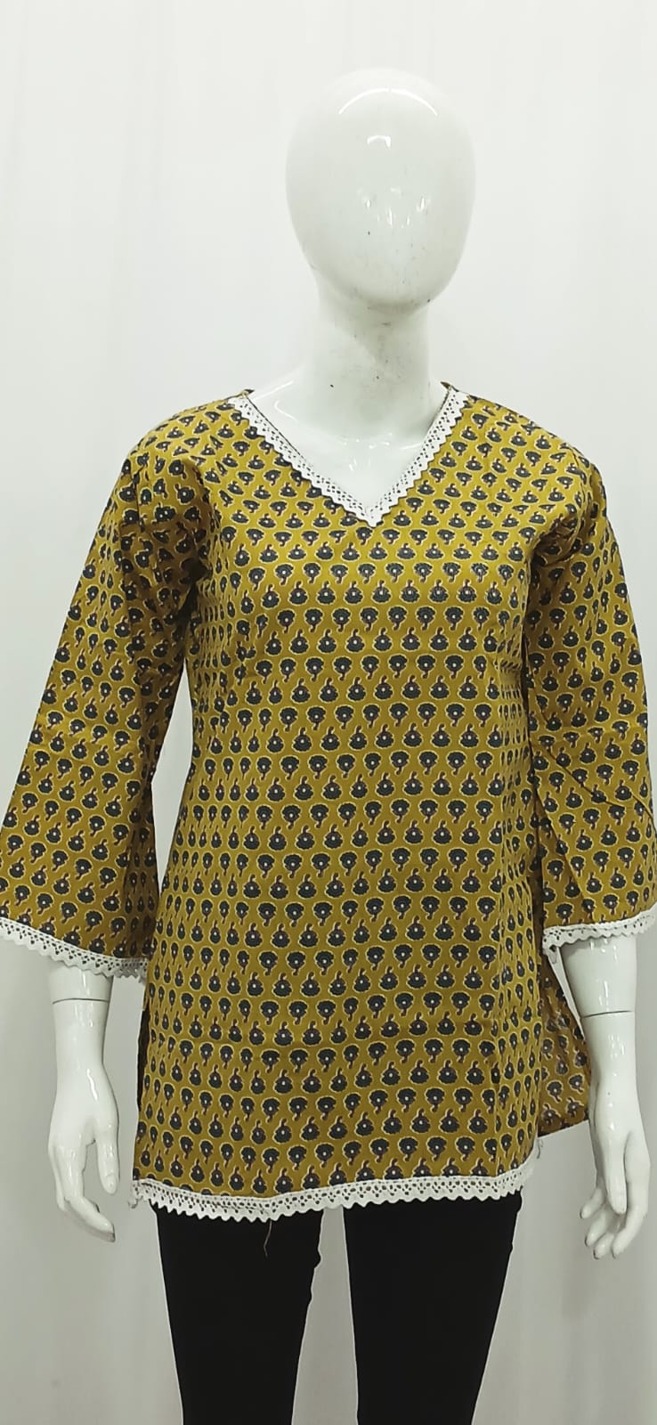 Mustard Yellow Block-Print Short Kurti with Lace Trims