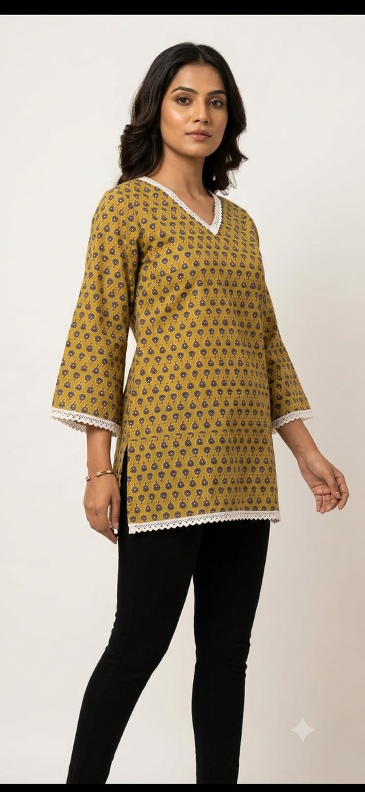 Mustard Yellow Block-Print Short Kurti with Lace Trims